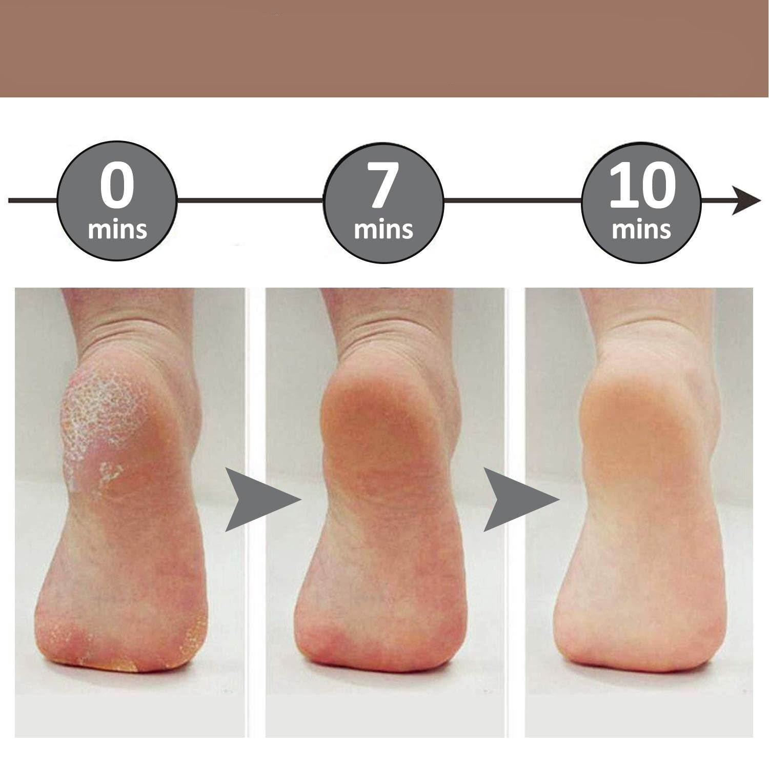 Soft Feet™ Electric Callus Remover