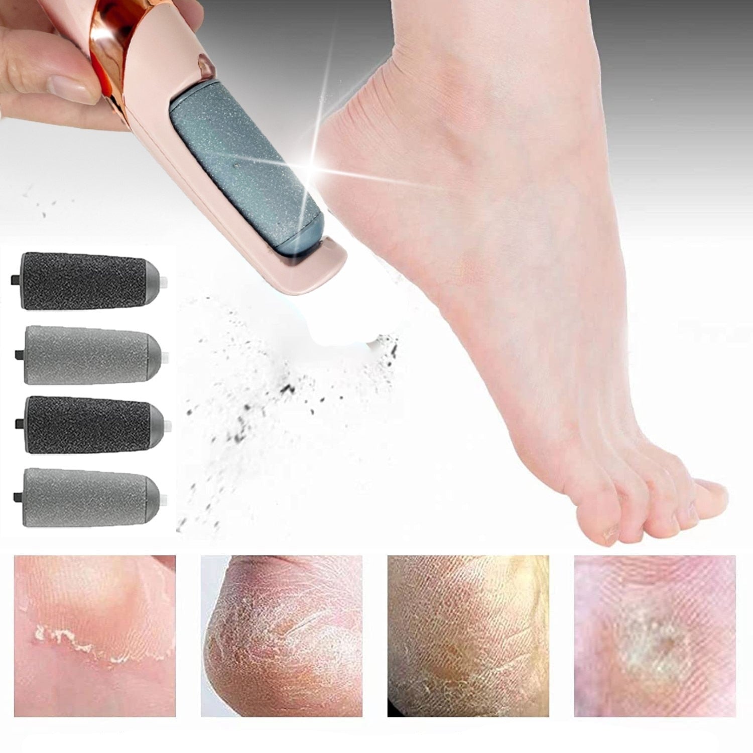 Soft Feet™ Electric Callus Remover