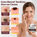 Biancat® KERAERASE Creme Reparador da pele 3 em 1 (50g)