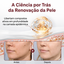 Biancat® KERAERASE Creme Reparador da pele 3 em 1 (50g)