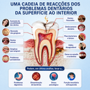 Ceоerty® Adesivo Reparador Dental ( 7 Unidades ) €29,90