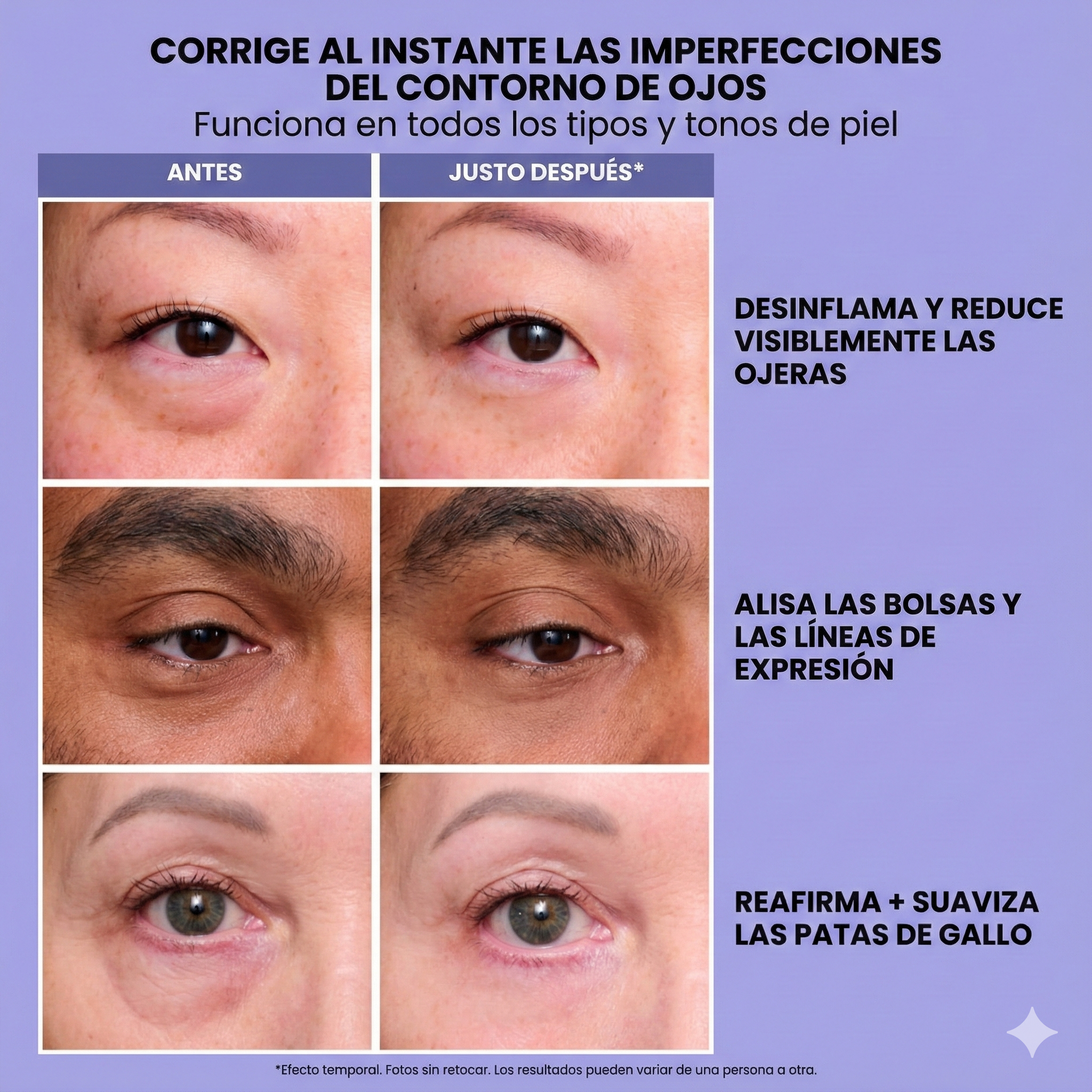 InfiniteLift | Rejuvenating Eye Tightening Gel