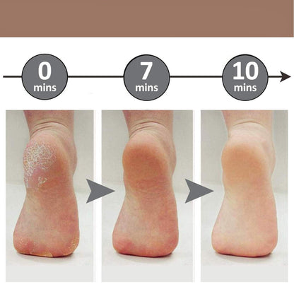 Soft Feet™ Electric Callus Remover